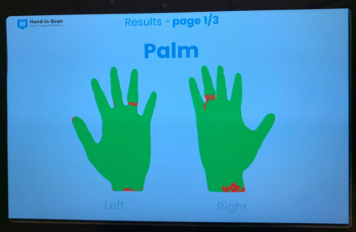 the Hand-in-Scan device